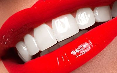 ТОП ошибок отбеливания, которые могут стоить Вам здоровья зубов